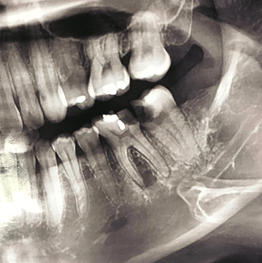 Treatment - cathedraldental