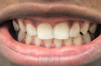 After - Maida Vale Dental Practice