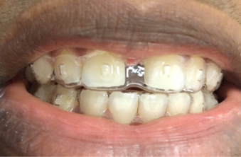 Before - Maida Vale Dental Practice
