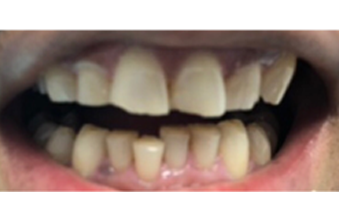 Before - Maida Vale Dental Practice