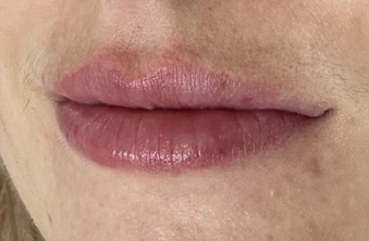 After - Maida Vale Dental Practice