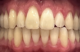 After - Maida Vale Dental Practice
