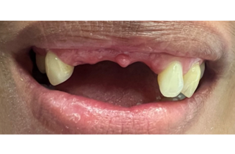 Before - Maida Vale Dental Practice
